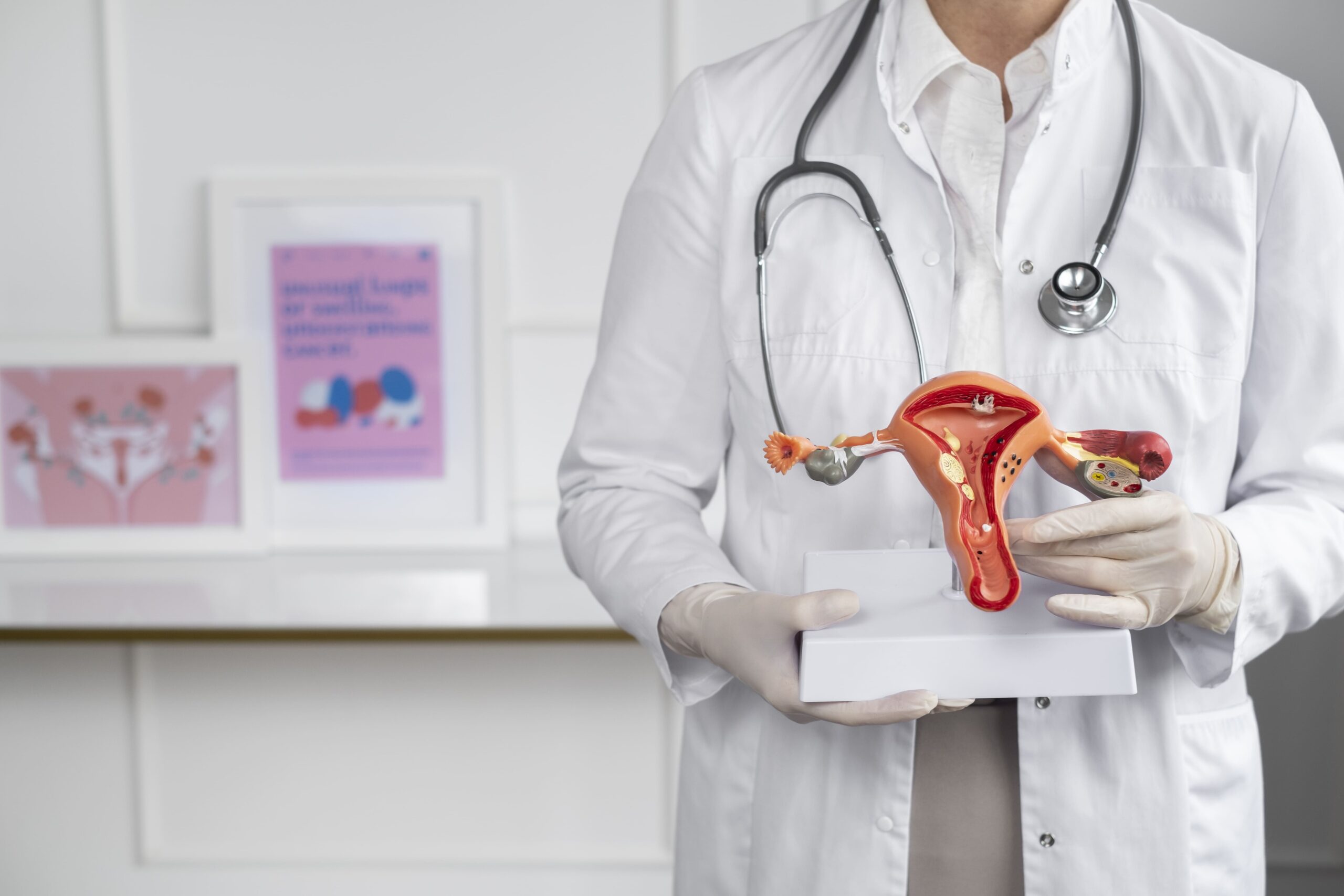 Estudo Glade Endometriose
