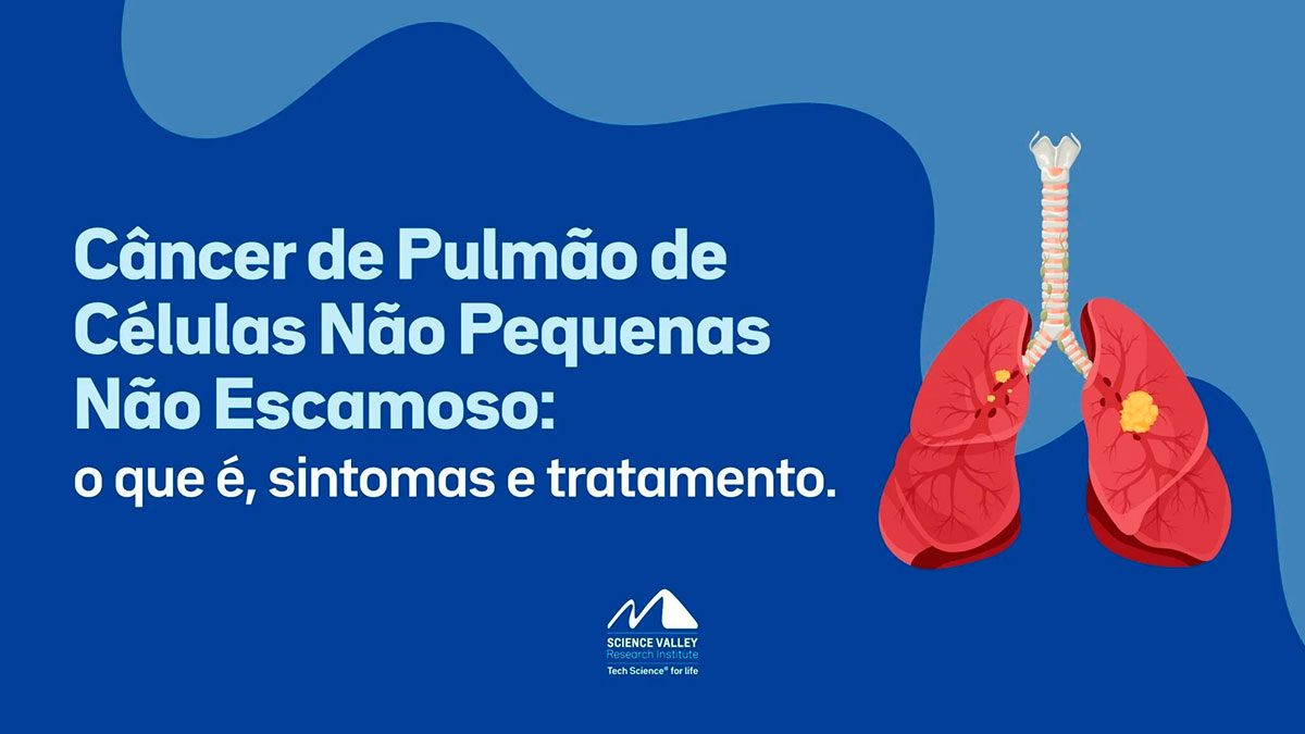 Ilustração de um pulmão humano mostrando as vias aéreas com o título Câncer de Pulmão de Células Não Pequenas Não Escamoso: o que é, sintomas e tratamento.