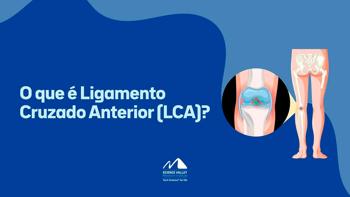 O que é Ligamento Cruzado Anterior (LCA)?