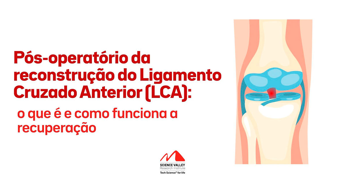 Pós-operatório da reconstrução do Ligamento Cruzado Anterior (LCA): o que é e como funciona a recuperação