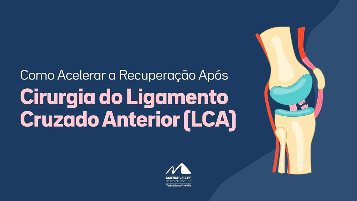 Como Acelerar a Recuperação Após Cirurgia do Ligamento Cruzado Anterior (LCA)