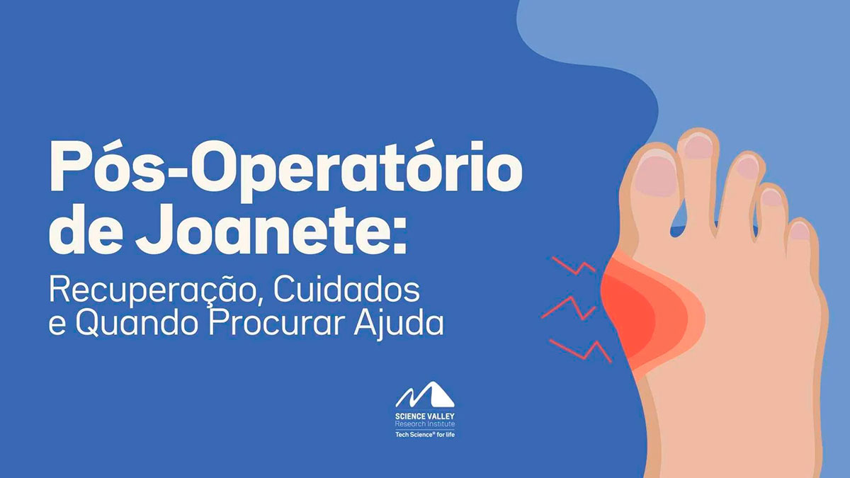 Pós-Operatório de Joanete: Recuperação, Cuidados e Quando Procurar Ajuda
