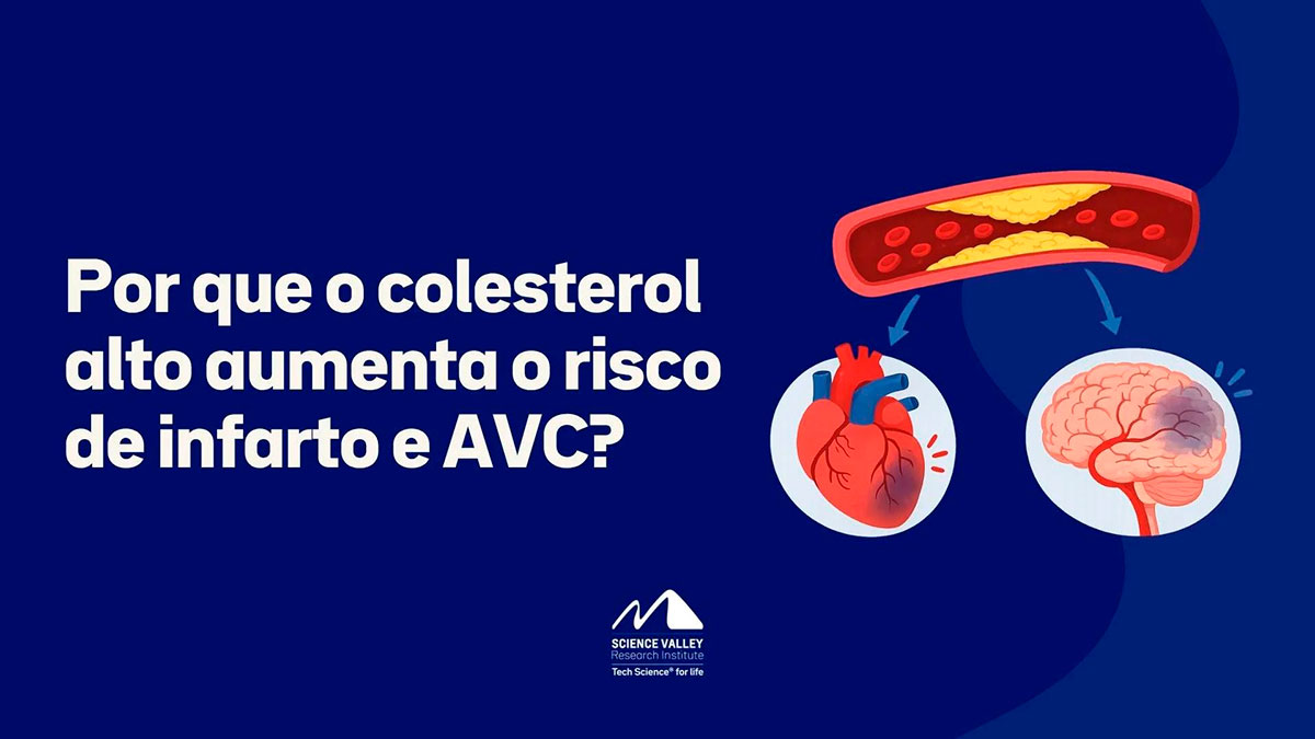 Ilustração mostrando uma artéria com acúmulo de gordura apontando para um coração e um cérebro, acompanhada do texto: Por que o colesterol alto aumenta o risco de infarto e AVC?